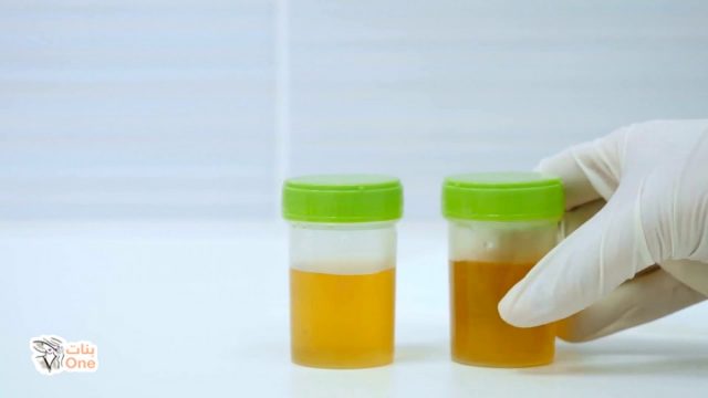 اختبار الحمل بالكلور وطريقة تطبيقه  