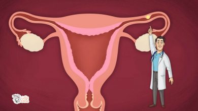 اعراض الحمل خارج الرحم الاكيده وأسبابه  