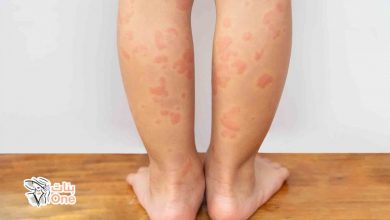 أسباب ظهور حساسية الجلد عند الأطفال  