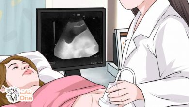 اسباب الحمل خارج الرحم  
