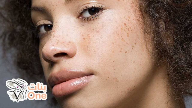 وصفة فعالة لإزالة البقع السوداء من الوجه  