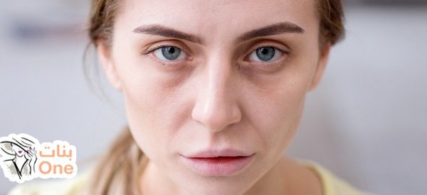 ما أسباب شحوب الوجه وما طرق العلاج؟  