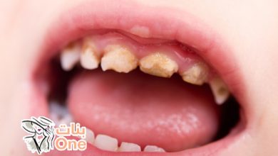 طرق الوقاية من تسوس الأسنان عند الأطفال  