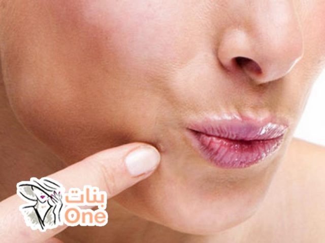 كيفية إزالة الاسمرار حول الفم  