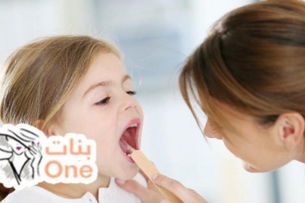 أسباب الفطريات لدى الأطفال في الفم وعلاجها  