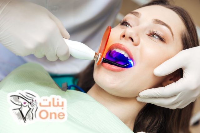 فوائد وأضرار تبييض الأسنان بالليزر  