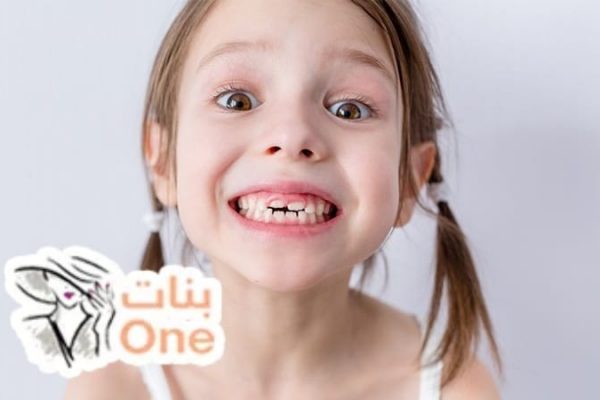 كم عدد الأسنان اللبنية عند الأطفال  