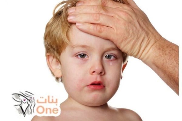 أعراض التهاب السحايا للأطفال والرضع  