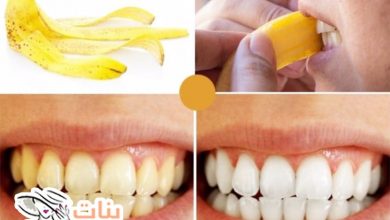 فوائد قشر الموز لتبييض الأسنان  