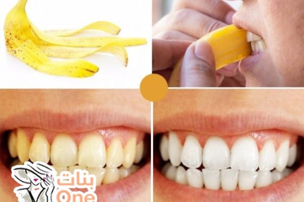 فوائد قشر الموز لتبييض الأسنان  