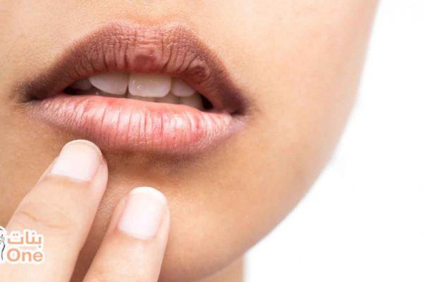 طرق علاج السواد حول الفم  