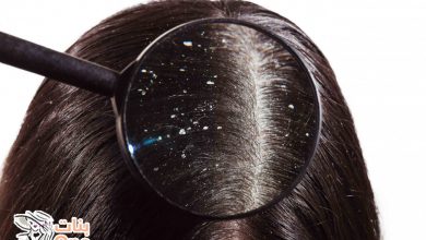 طريقة التخلص من قشرة الشعر  