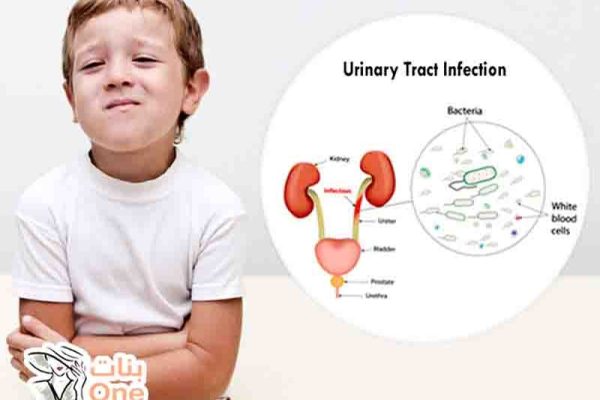 أعراض التهاب البول عند الأطفال  
