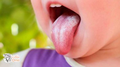 أسباب الفطريات في الفم عند الأطفال  