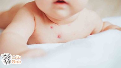 أسباب ظهور حبوب حمراء في جسم الأطفال  