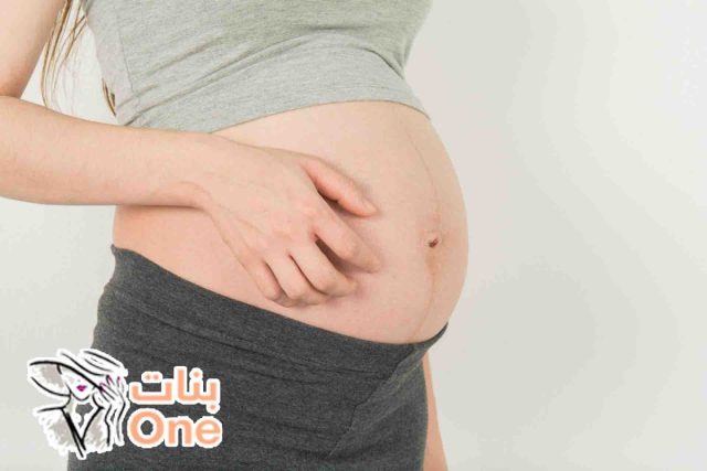 أسباب الحكة عند الحامل في الشهر الثامن وطرق علاجها  