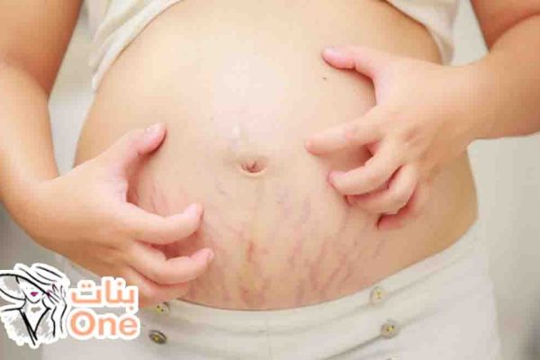 أسباب الحكة عند الحامل في الشهر الثامن وطرق علاجها  