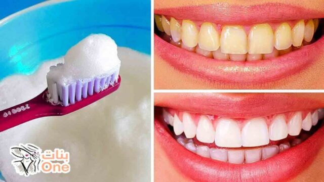 كيفية تبييض الأسنان بسرعة  