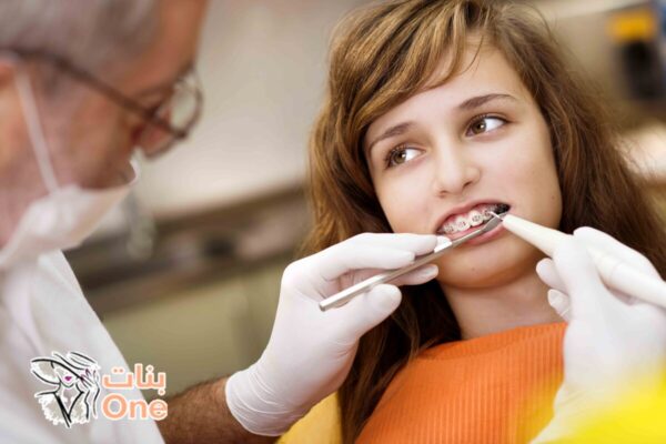 مراحل تقويم الأسنان  
