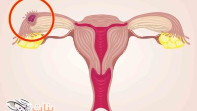 علامات الحمل خارج الرحم  