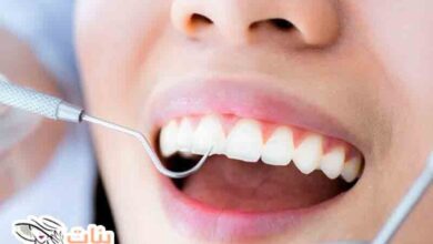 كيفية المحافظة على الأسنان  