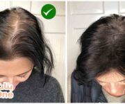 طريقة سهلة لعلاج تساقط الشعر  