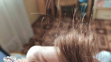 طرق معالجة الشعر التالف  